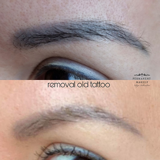Tattoo Removal Solution removes green, yellow, red, orange, beige, purple, blue, grey and of course titanium dioxide the white pigment.